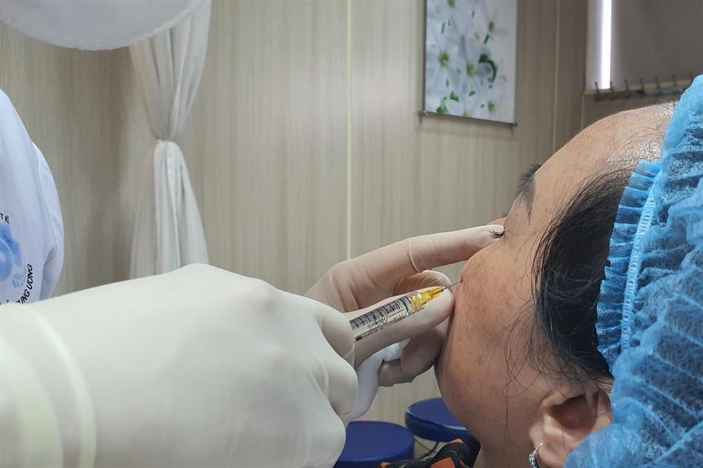 Tại sao độc chất botulinum được dùng trong thẩm mỹ?-1