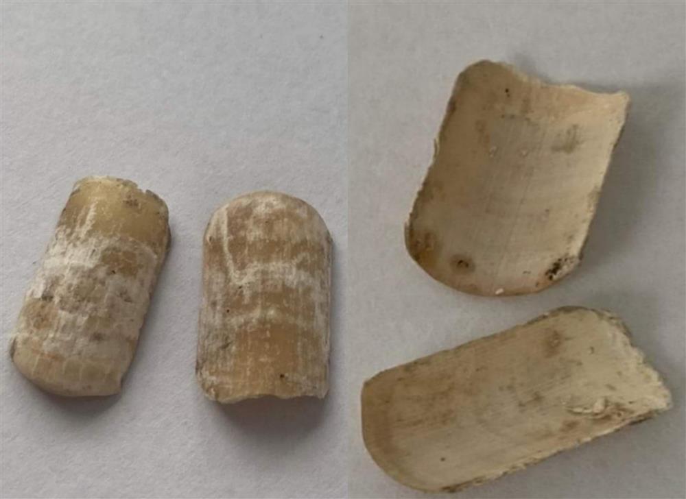 Công an tiếp tục tìm danh tính nạn nhân vụ chân tay bị đốt cháy trong túi xách-1