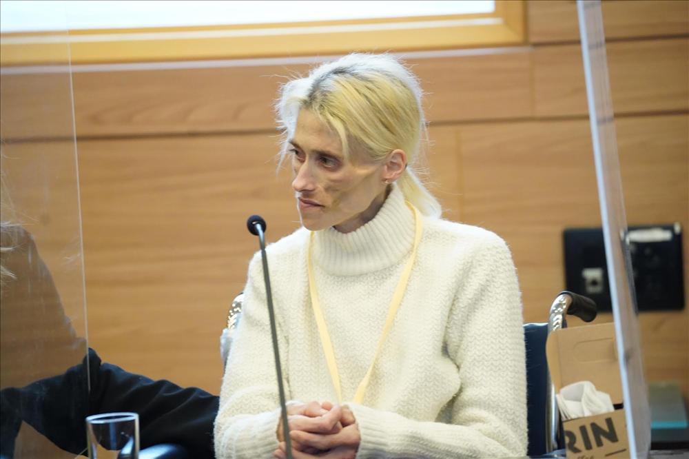 Người mẫu 35 tuổi qua đời chỉ nặng 23 kg, rụng hết răng-1