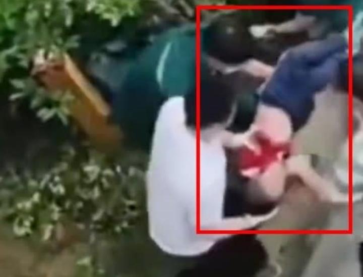 Học theo phim hoạt hình, bé gái thoát chết diệu kỳ khi nhảy từ tầng 26-2