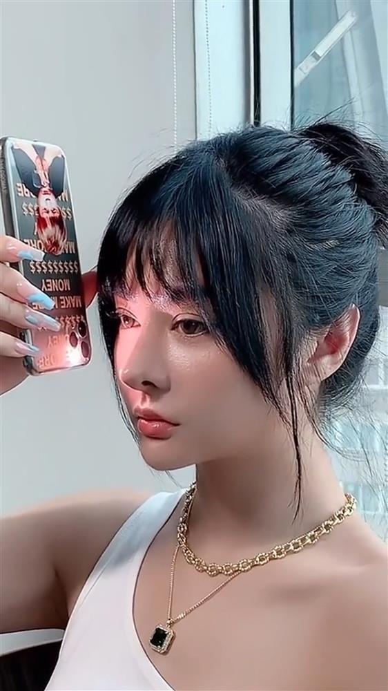 Có phải nâng mũi với chất liệu độn đắt tiền là bền, chuyên gia tiết lộ sự thật-2