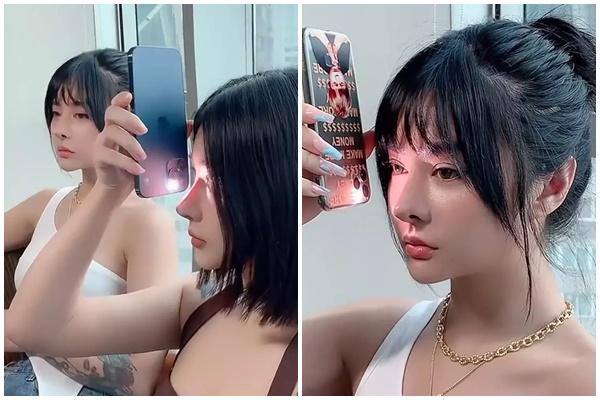 Những trường hợp không nên nâng mũi-2