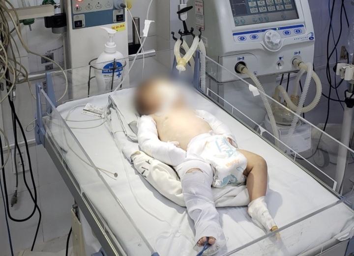 Sức khỏe bé gái 3 tháng tuổi ở Đà Lạt bị người tình của mẹ bạo hành giờ ra sao?-1