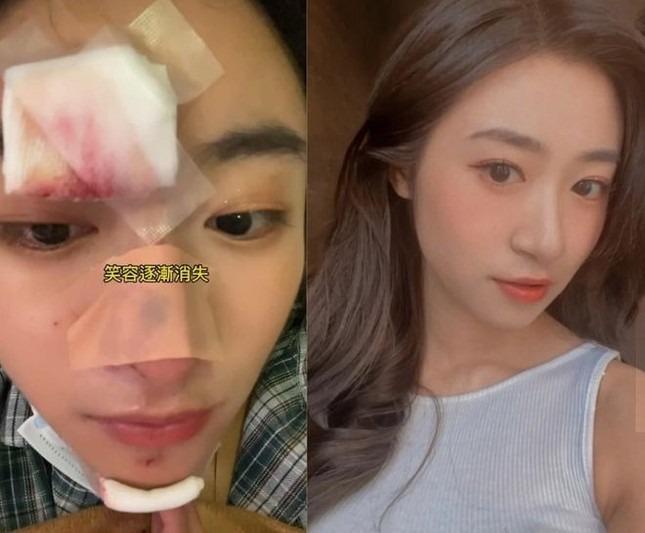 Nữ diễn viên Hong Kong ngất xỉu, ngã đập mặt xuống đường-1