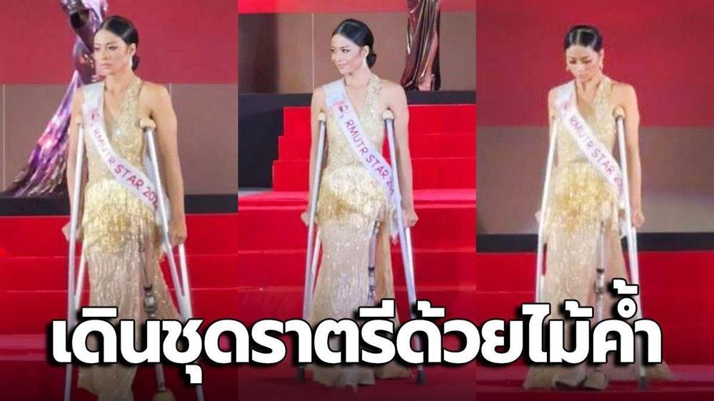 Thí sinh hoa hậu cụt chân trình diễn váy dạ hội gây chú ý-1