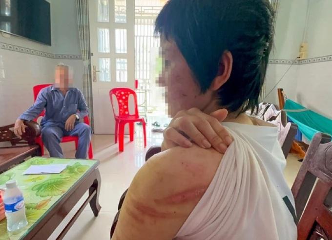 Nghi phạm bạo hành vợ mang thai 7 tháng từng có 2 đời vợ và 7 con riêng-2