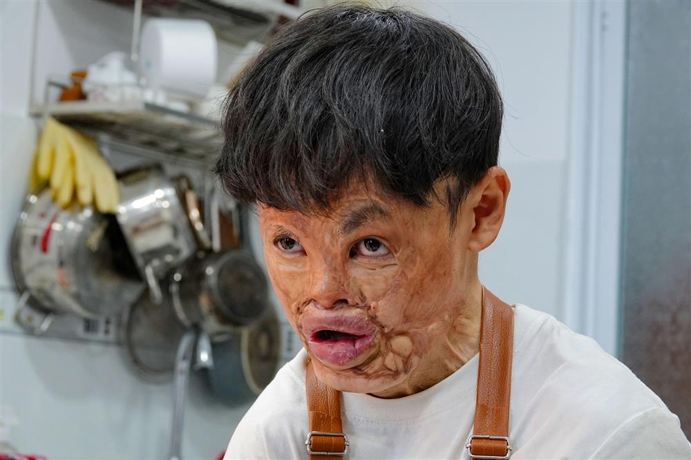 Chàng trai cháy cả gương mặt mở tiệm bánh bán... tình yêu-6