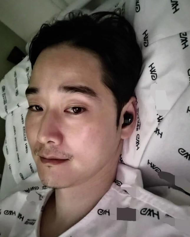 Tình trạng nam diễn viên bị rắn độc cắn-1