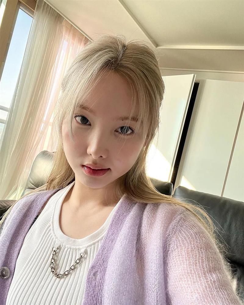 Nayeon gây sốc với mái tóc đứt gãy sau tẩy, nuôi dài một năm vẫn hư tổn nặng-1