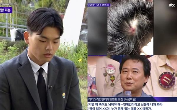 Hợp đồng nô lệ của các sao Kpop: Bào mòn từ thể xác đến tinh thần-5