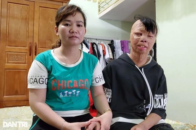 Cuộc sống của cậu bé bị bố ruột đổ xăng thiêu sống sau 12 năm-4