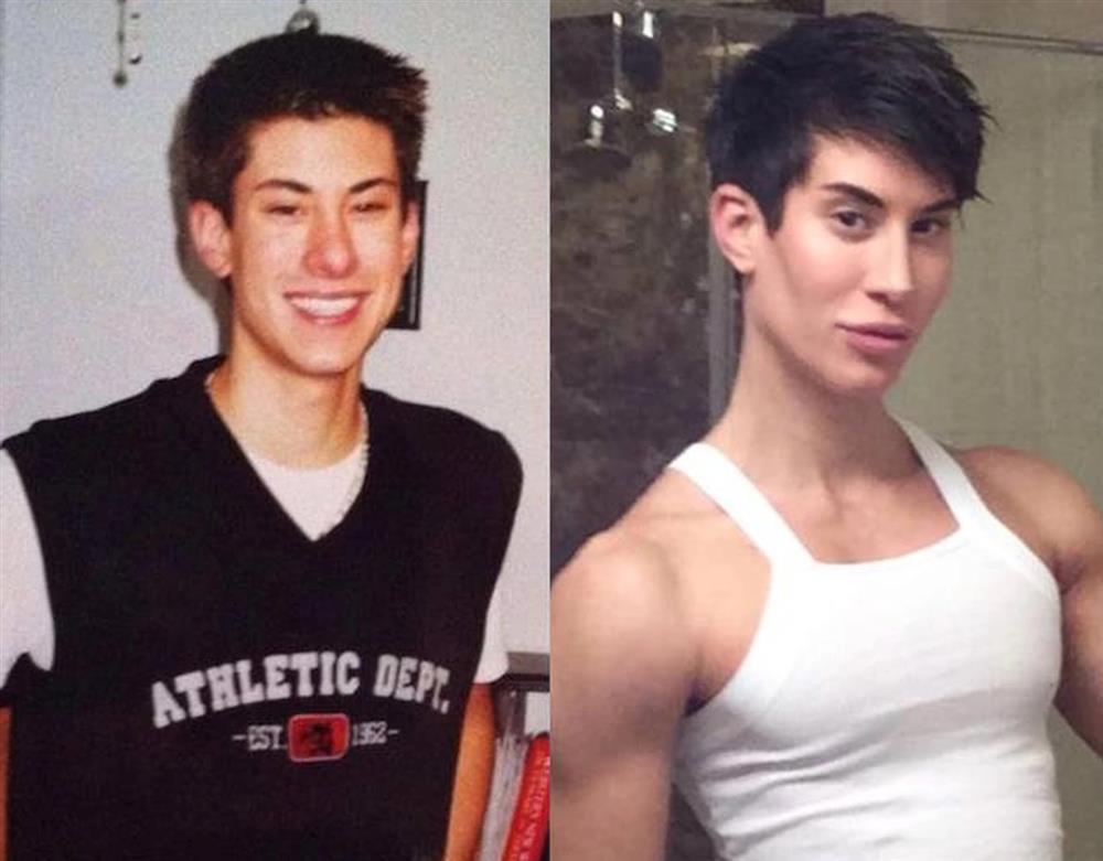 Cuộc sống sang chảnh của búp bê Ken chi 23 tỷ đồng phẫu thuật thẩm mỹ-2