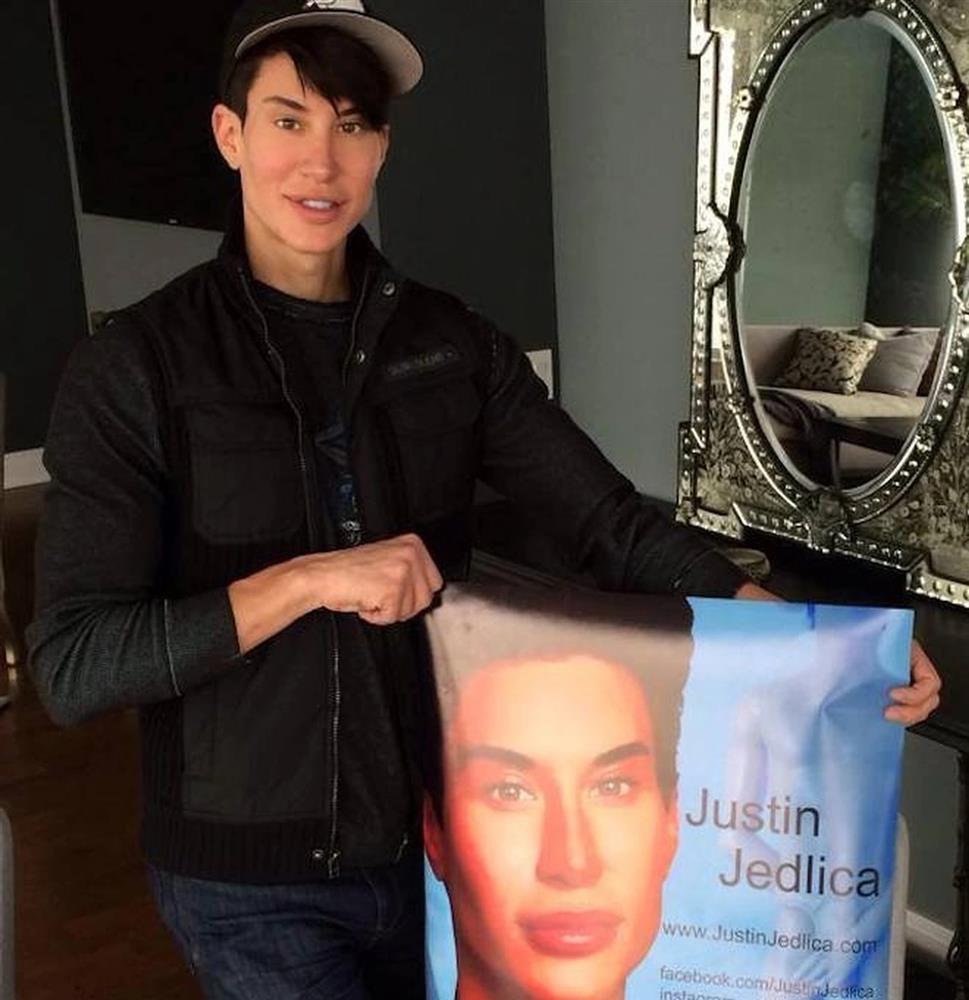 Cuộc sống sang chảnh của búp bê Ken chi 23 tỷ đồng phẫu thuật thẩm mỹ-6