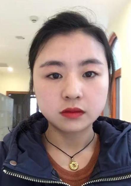 Cắt da mặt được 1 tháng, người phụ nữ 48 tuổi cải lão hoàn đồng, biến thành người khác-5