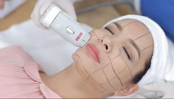 Cắt da mặt được 1 tháng, người phụ nữ 48 tuổi cải lão hoàn đồng, biến thành người khác-7