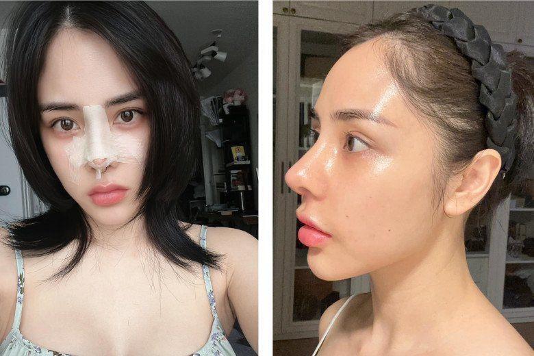 Bị nói sửa hết mặt vẫn không đẹp, bạn gái Huỳnh Anh cầu xin CĐM-8