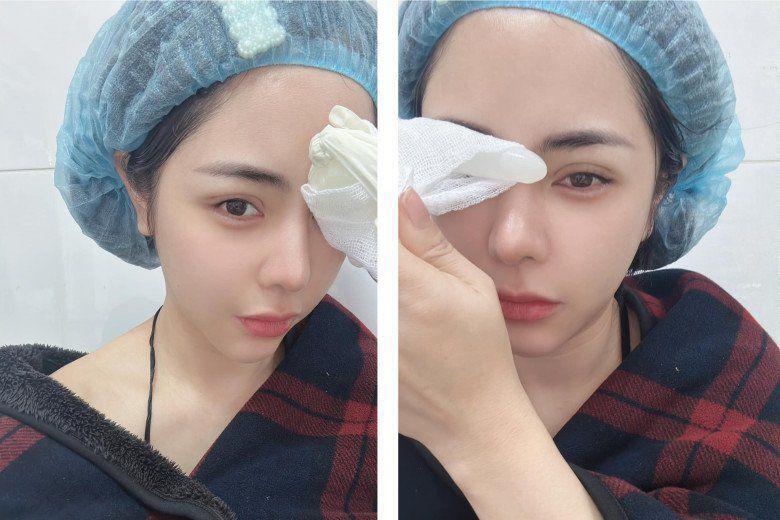 Bị nói sửa hết mặt vẫn không đẹp, bạn gái Huỳnh Anh cầu xin CĐM-9