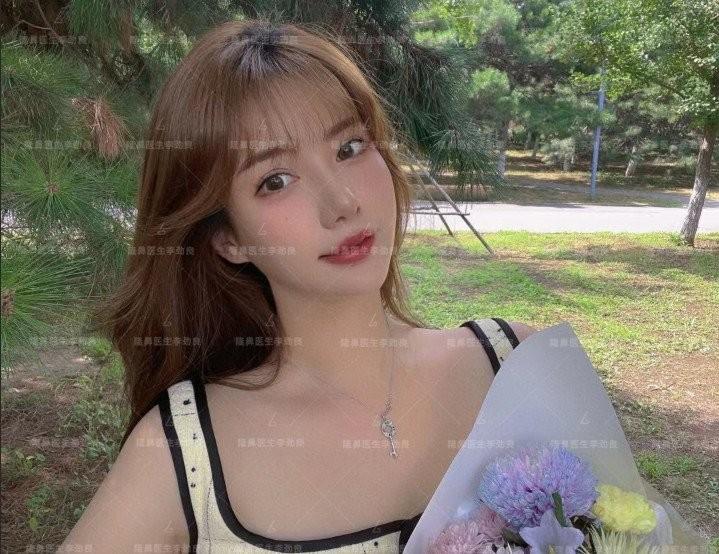 Muốn đẹp nhưng không đụng dao kéo, cô gái xỏ 16 sợi chỉ vào mũi và cái kết-5