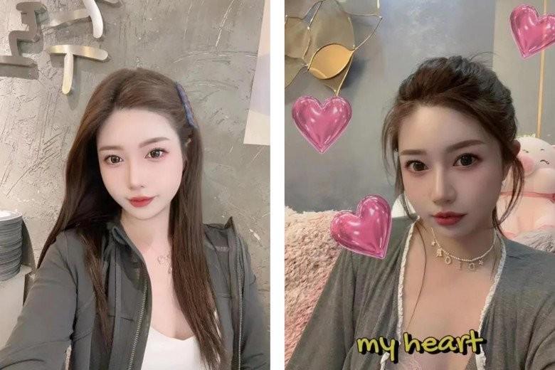 Muốn đẹp nhưng không đụng dao kéo, cô gái xỏ 16 sợi chỉ vào mũi và cái kết-6