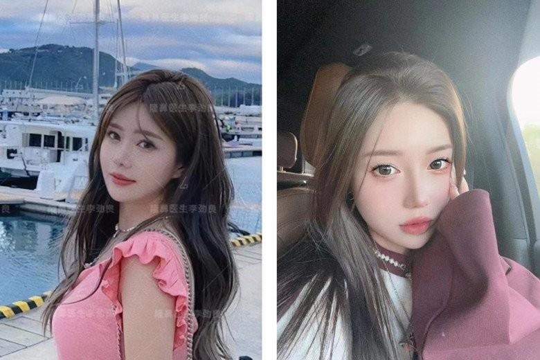 Muốn đẹp nhưng không đụng dao kéo, cô gái xỏ 16 sợi chỉ vào mũi và cái kết-7