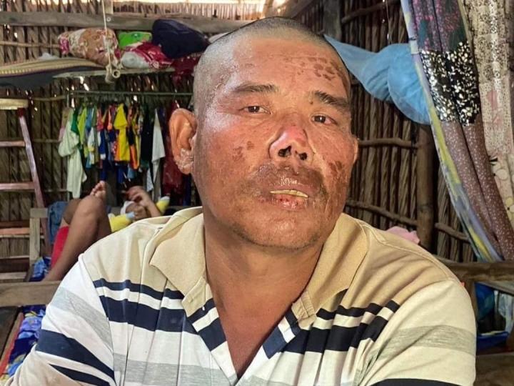 Ngư dân kể chuyện sống sót thần kỳ sau 4 ngày rơi xuống biển-2