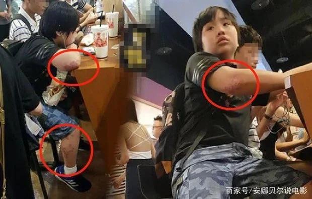 3 anh em sao nhí bị gia đình lợi dụng như cỗ máy in tiền giờ ra sao?-5