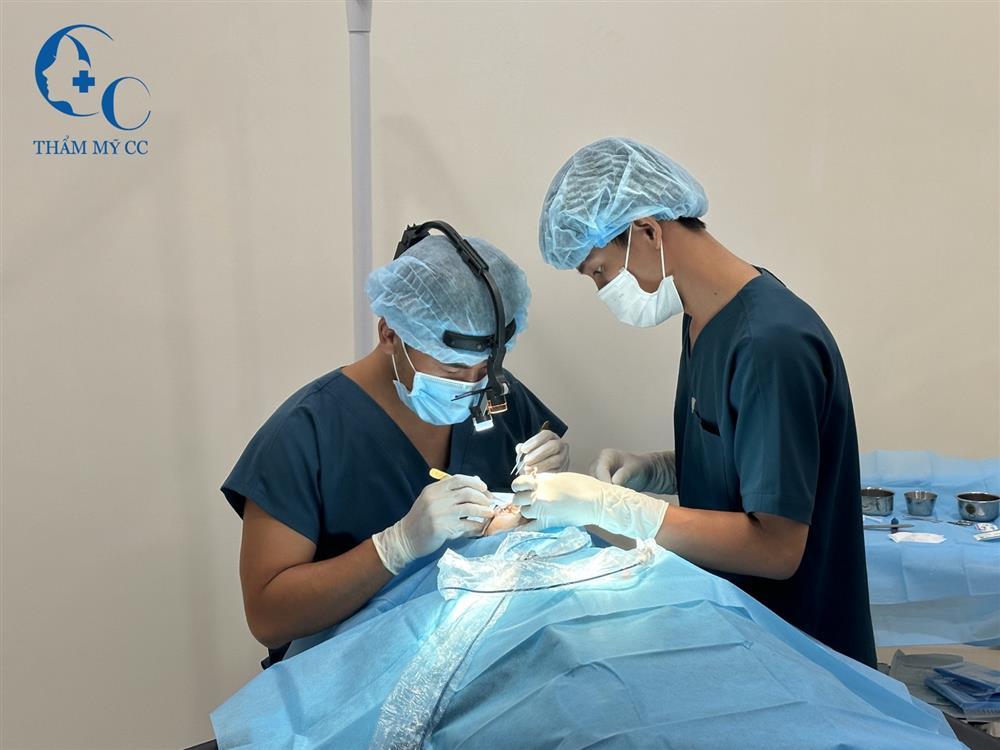 Bác sĩ Thẩm mỹ CC tư vấn cách cắt mí Plasma đẹp tự nhiên và an toàn-2