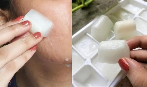 Không cần mỹ phẩm tiền triệu, chỉ cần thứ nước vài nghìn: Trị nám, xóa thâm-5