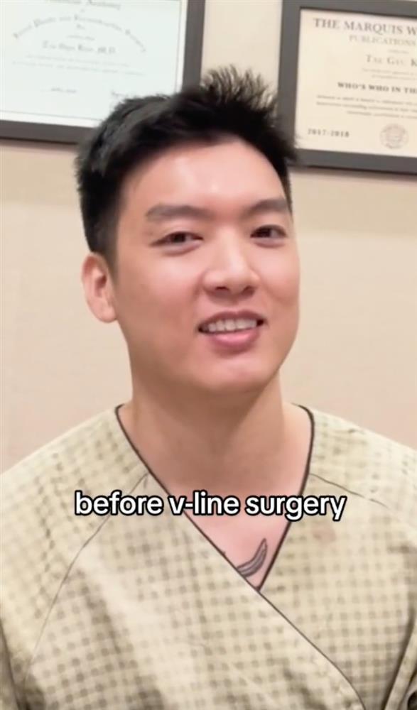 Chàng trai Mỹ gốc Việt Người Ấy Là Ai phẫu thuật thẩm mỹ, diện mạo hiện tại thế nào?-2