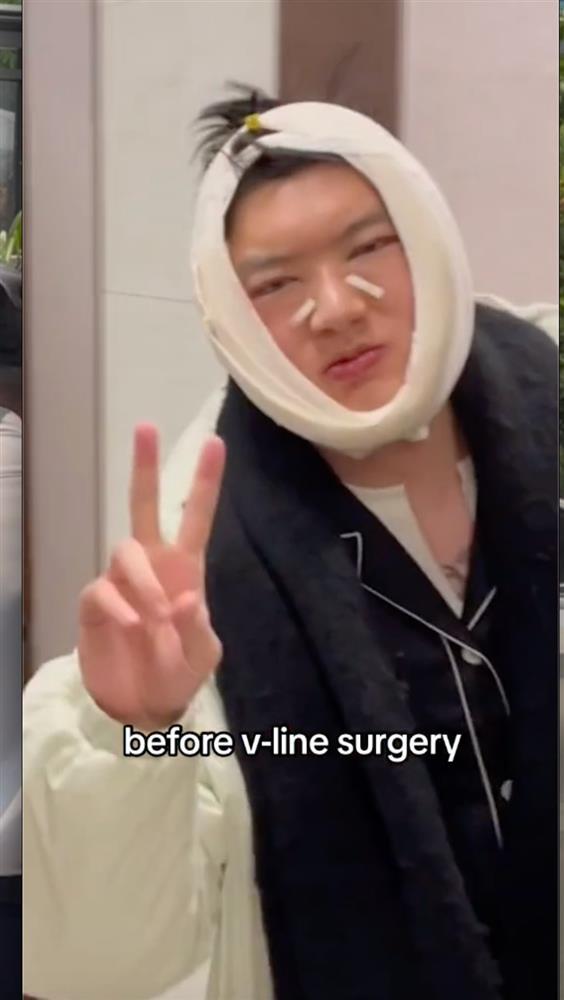 Chàng trai Mỹ gốc Việt Người Ấy Là Ai phẫu thuật thẩm mỹ, diện mạo hiện tại thế nào?-3