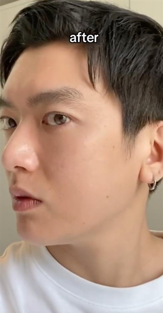 Chàng trai Mỹ gốc Việt Người Ấy Là Ai phẫu thuật thẩm mỹ, diện mạo hiện tại thế nào?-4