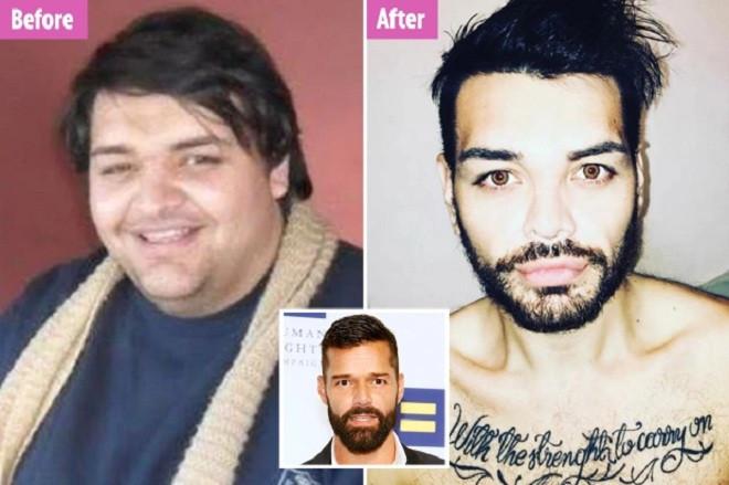 Chịu đau đớn và di chứng của 40 ca thẩm mỹ để trông giống thần tượng-2