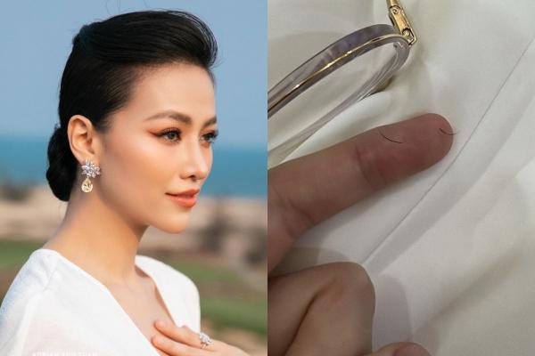 Hoa hậu Phương Khánh tiết lộ tình trạng sức khỏe sau khi mắc bệnh cường giáp-4