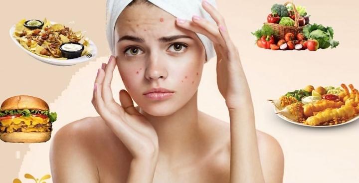 Mùa hè ăn gì để da khoẻ đẹp, tránh nổi mụn?-1
