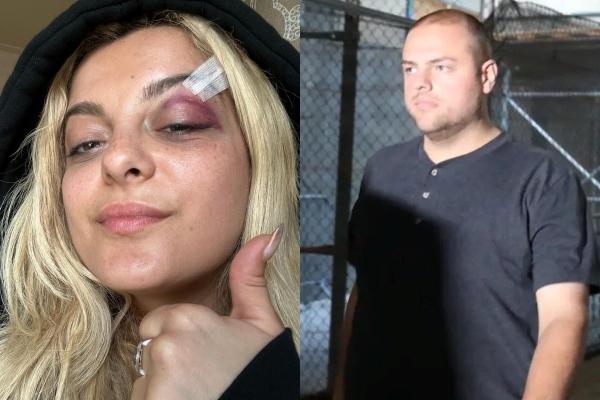 Nữ ca sĩ choáng váng khi bị fan cuồng tát thẳng mặt ngay trên sân khấu-2