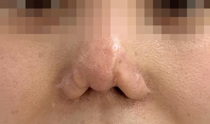 Chủ spa bị băm nát mũi sau 9 lần nâng cấp sửa chữa-1