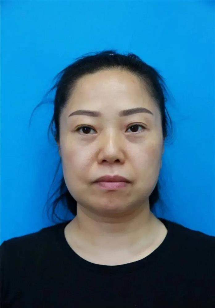 Người phụ nữ 47 tuổi bỏ nhà đi cắt da, 7 ngày sau trở về gia đình nhận không ra-1