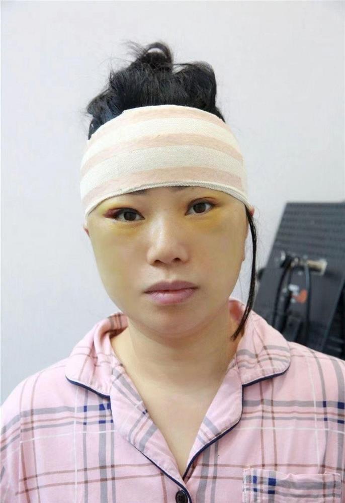 Người phụ nữ 47 tuổi bỏ nhà đi cắt da, 7 ngày sau trở về gia đình nhận không ra-2