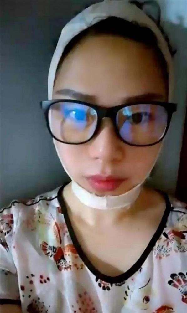 Người phụ nữ 47 tuổi bỏ nhà đi cắt da, 7 ngày sau trở về gia đình nhận không ra-3