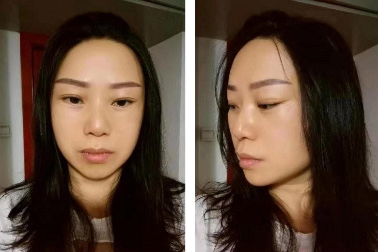 Người phụ nữ 47 tuổi bỏ nhà đi cắt da, 7 ngày sau trở về gia đình nhận không ra-4