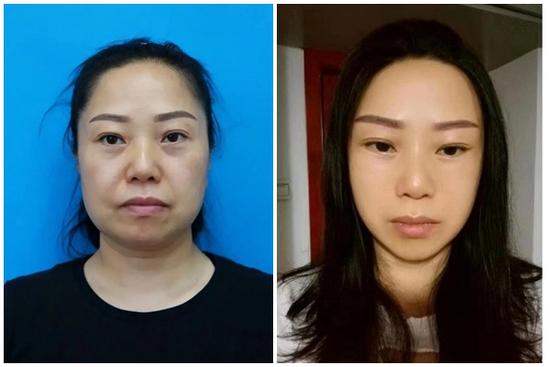 Người phụ nữ 47 tuổi bỏ nhà đi 'cắt da', 7 ngày sau trở về gia đình nhận không ra