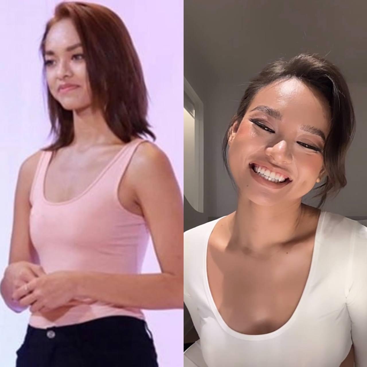 Mai Ngô xuất hiện khác lạ, bị nghi phẫu thuật thẩm mỹ-2