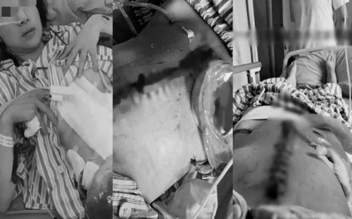 Vợ bị đánh nát người, thủng nội tạng vì muốn ly hôn, cư dân mạng phẫn nộ-1