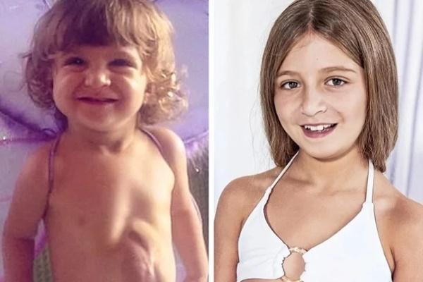 Cô bé ngủ li bì suốt 9 năm khi tỉnh dậy đã là thiếu nữ-2