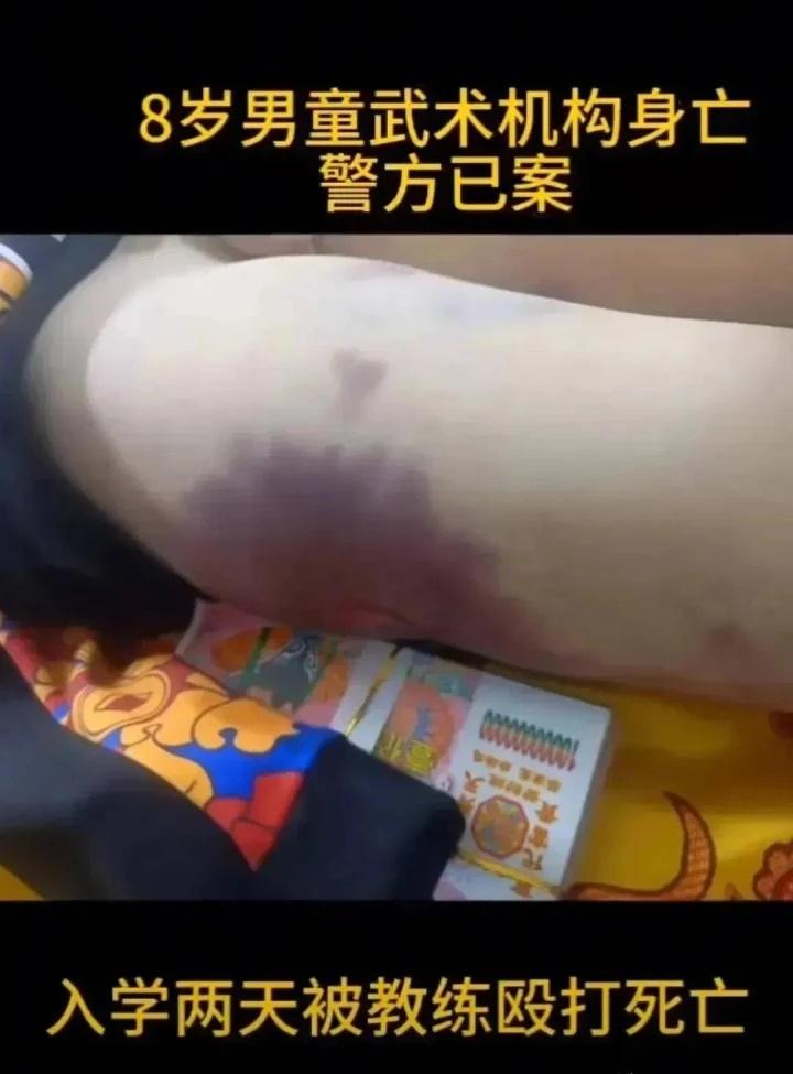 Cậu bé 8 tuổi đột tử sau một buổi học võ-2