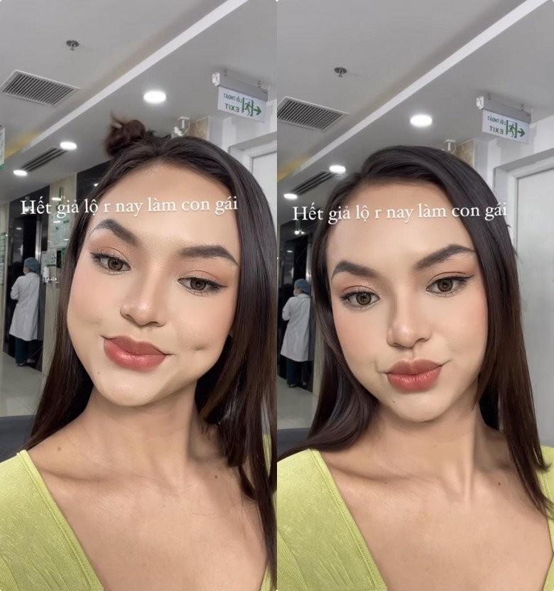 Không cao bằng Mai Phương Thúy nhưng vòng 3 ngang hàng, người đẹp lận đận cặp chân mày ẩn ý chuyện thẩm mỹ-2