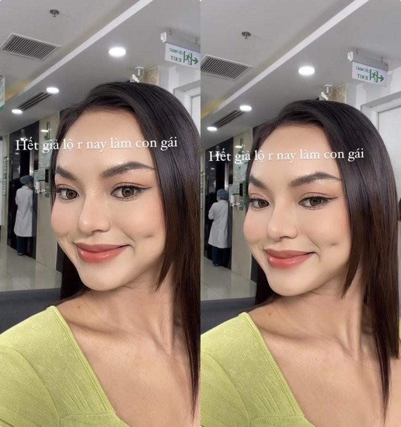 Không cao bằng Mai Phương Thúy nhưng vòng 3 ngang hàng, người đẹp lận đận cặp chân mày ẩn ý chuyện thẩm mỹ-3