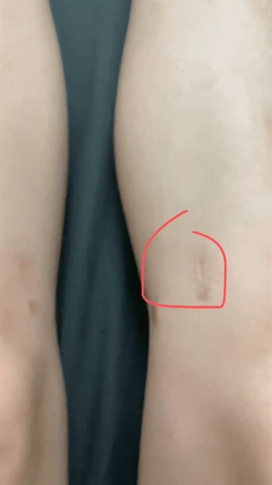 Vóc dáng và cuộc sống hiện tại của cô gái Hà Nội chi hơn 200 triệu kéo chân-4