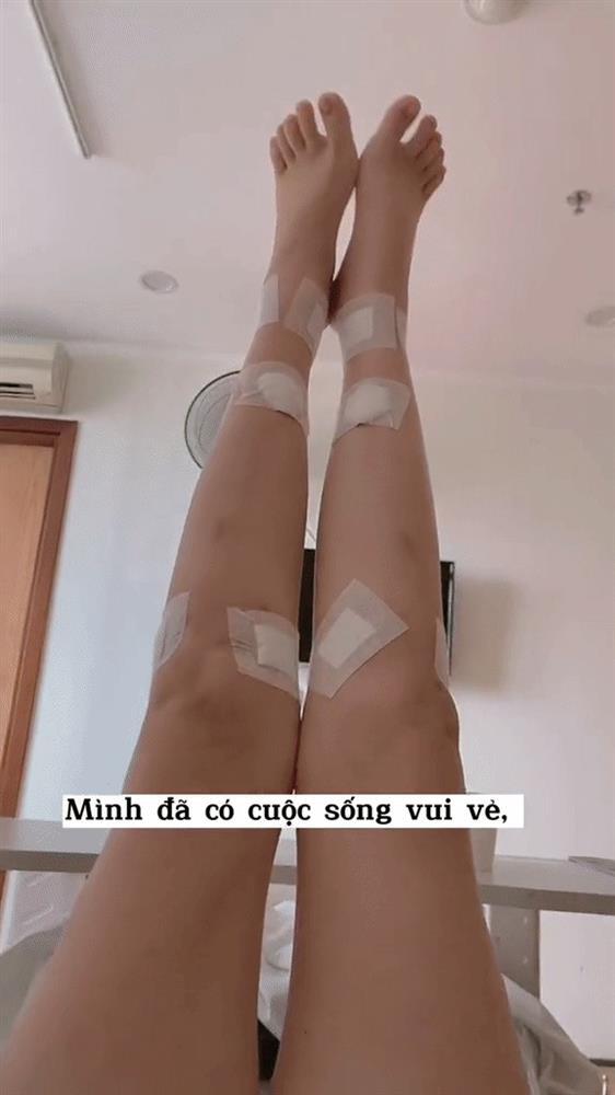 Vóc dáng và cuộc sống hiện tại của cô gái Hà Nội chi hơn 200 triệu kéo chân-5