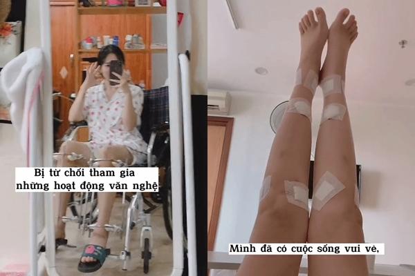 Nữ người mẫu bị chỉ trích vì chi gần 4 tỷ đồng để kéo dài chân-4